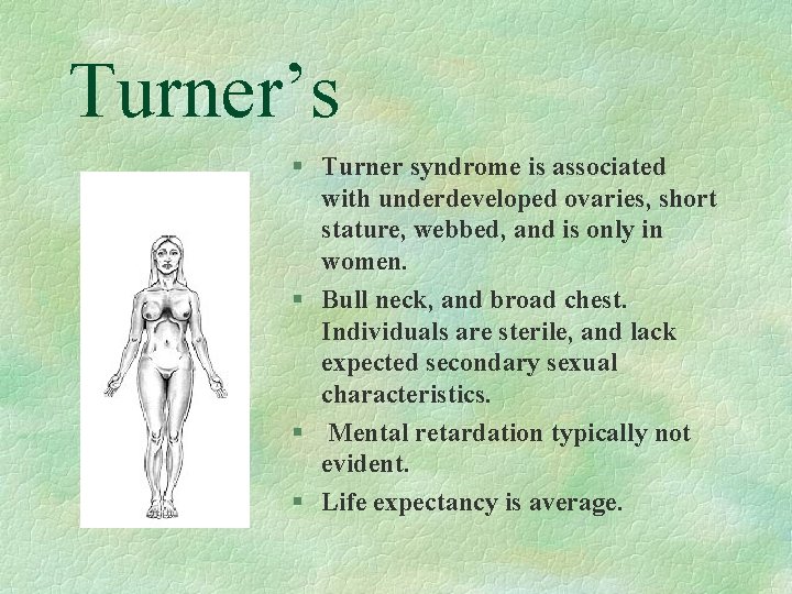 Turner’s § Turner syndrome is associated with underdeveloped ovaries, short stature, webbed, and is