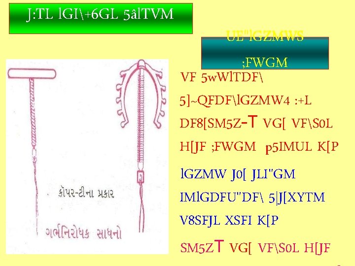 L J 7 Fg Vg 8sgm M Wmz