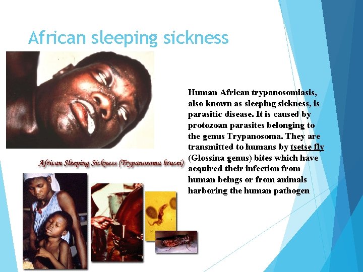 African sleeping sickness Human African trypanosomiasis, also known as sleeping sickness, is parasitic disease.