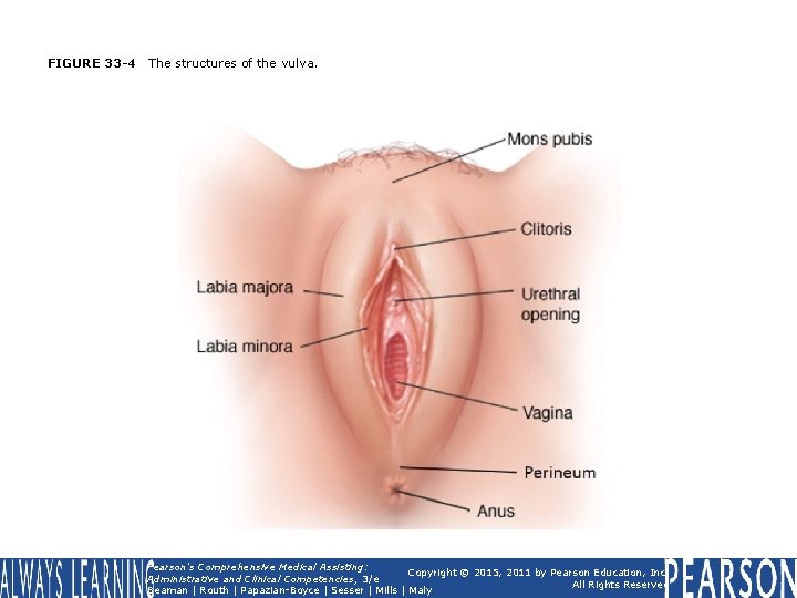 FIGURE 33 -4 The structures of the vulva. Pearson's Comprehensive Medical Assisting: Copyright © FIGURE 33 -4 The structures of the vulva. Pearson's Comprehensive Medical Assisting: Copyright ©