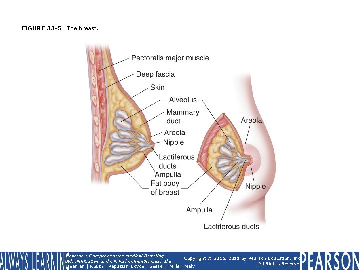 FIGURE 33 -5 The breast. Pearson's Comprehensive Medical Assisting: Copyright © 2015, 2011 by FIGURE 33 -5 The breast. Pearson's Comprehensive Medical Assisting: Copyright © 2015, 2011 by
