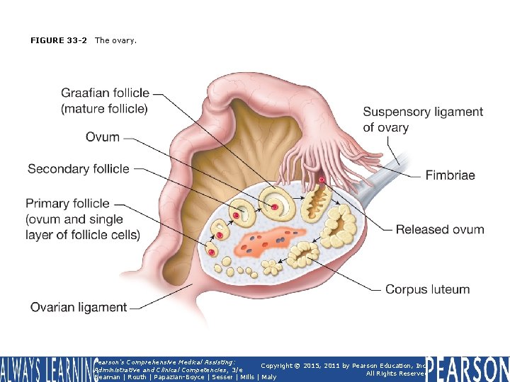 FIGURE 33 -2 The ovary. Pearson's Comprehensive Medical Assisting: Copyright © 2015, 2011 by FIGURE 33 -2 The ovary. Pearson's Comprehensive Medical Assisting: Copyright © 2015, 2011 by