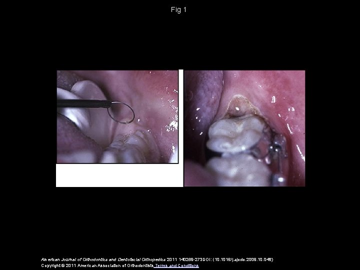 Fig 1 American Journal of Orthodontics and Dentofacial Orthopedics 2011 140269 -273 DOI: (10.