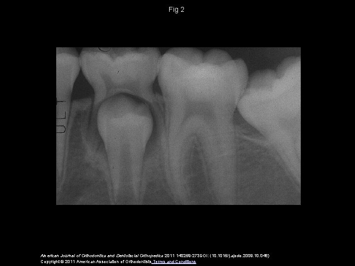Fig 2 American Journal of Orthodontics and Dentofacial Orthopedics 2011 140269 -273 DOI: (10.