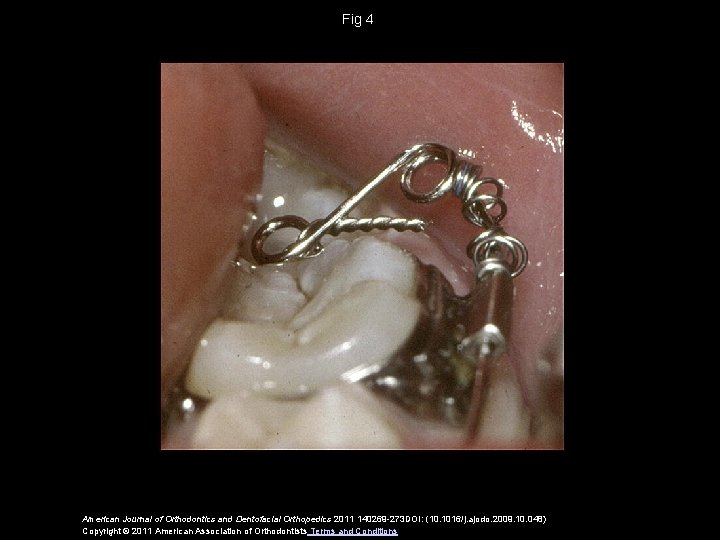 Fig 4 American Journal of Orthodontics and Dentofacial Orthopedics 2011 140269 -273 DOI: (10.