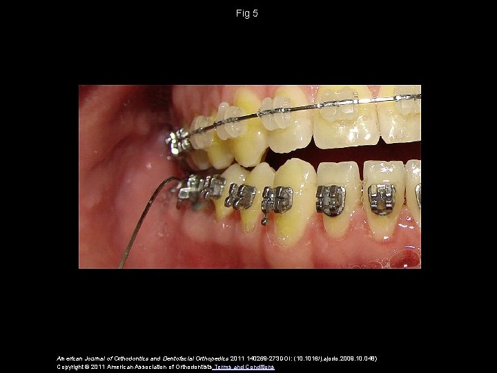 Fig 5 American Journal of Orthodontics and Dentofacial Orthopedics 2011 140269 -273 DOI: (10.