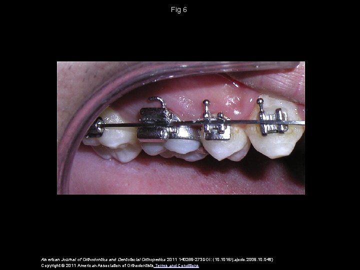 Fig 6 American Journal of Orthodontics and Dentofacial Orthopedics 2011 140269 -273 DOI: (10.