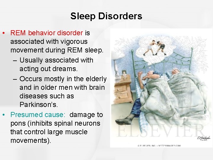 Sleep Disorders • REM behavior disorder is associated with vigorous movement during REM sleep.