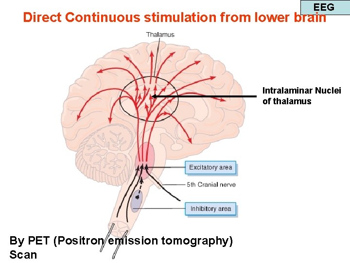 EEG Direct Continuous stimulation from lower brain Intralaminar Nuclei of thalamus By PET (Positron