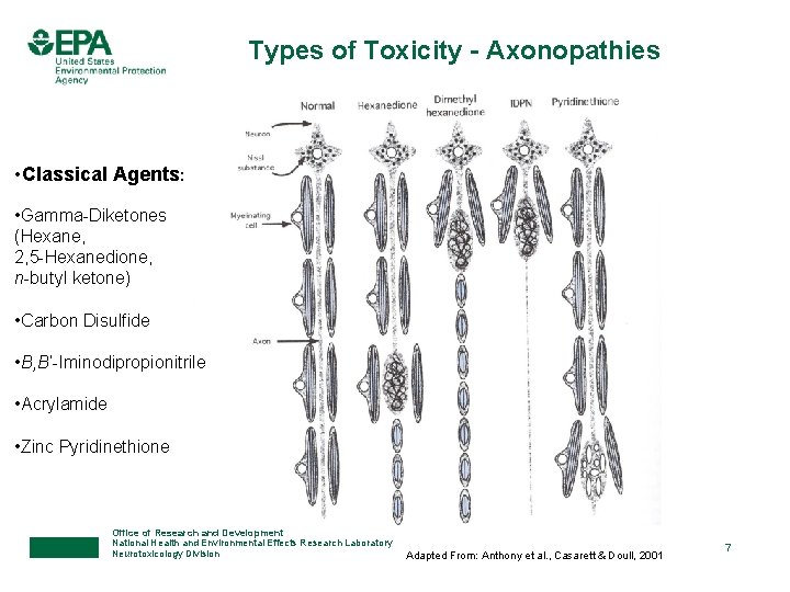 Types of Toxicity - Axonopathies • Classical Agents: • Gamma-Diketones (Hexane, 2, 5 -Hexanedione,