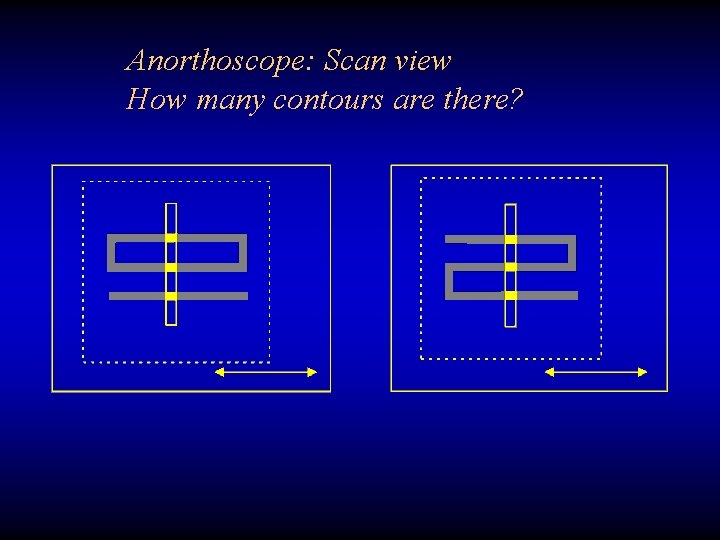 Anorthoscope: Scan view How many contours are there? 