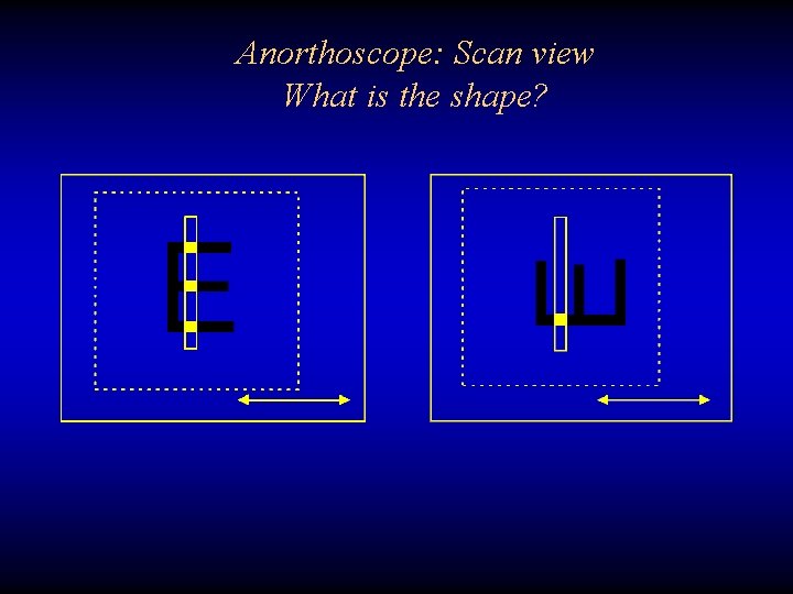 Anorthoscope: Scan view What is the shape? 