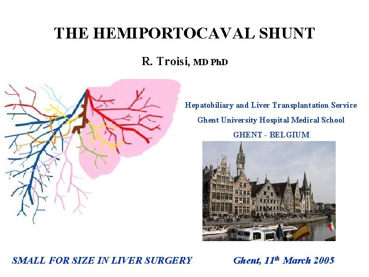 THE HEMIPORTOCAVAL SHUNT R. Troisi, MD Ph. D Hepatobiliary and Liver Transplantation Service Ghent THE HEMIPORTOCAVAL SHUNT R. Troisi, MD Ph. D Hepatobiliary and Liver Transplantation Service Ghent