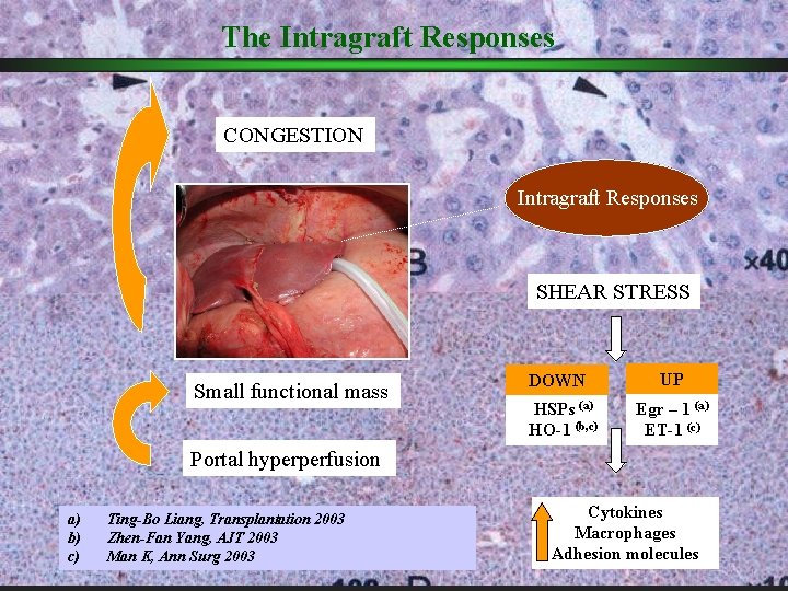 The Intragraft Responses CONGESTION Intragraft Responses SHEAR STRESS Small functional mass DOWN HSPs (a) The Intragraft Responses CONGESTION Intragraft Responses SHEAR STRESS Small functional mass DOWN HSPs (a)