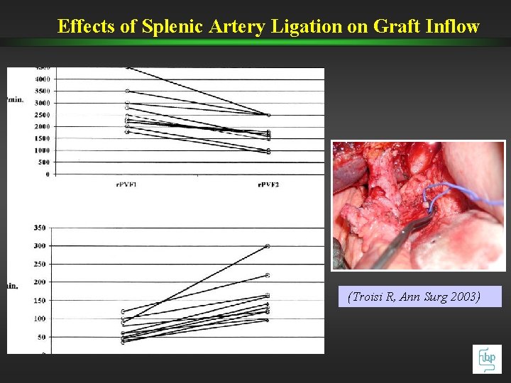 Effects of Splenic Artery Ligation on Graft Inflow (Troisi R, Ann Surg 2003) Effects of Splenic Artery Ligation on Graft Inflow (Troisi R, Ann Surg 2003)