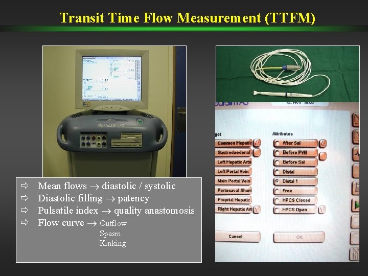 Transit Time Flow Measurement (TTFM) ð ð Mean flows diastolic / systolic Diastolic filling Transit Time Flow Measurement (TTFM) ð ð Mean flows diastolic / systolic Diastolic filling