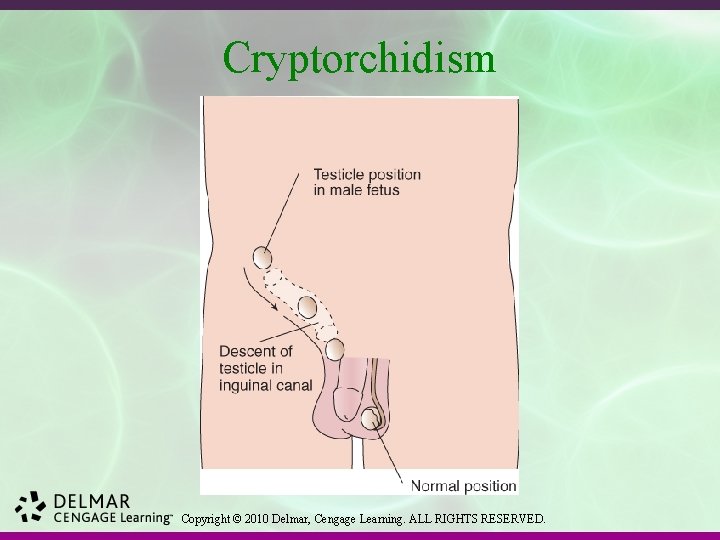 Cryptorchidism Copyright © 2010 Delmar, Cengage Learning. ALL RIGHTS RESERVED. 