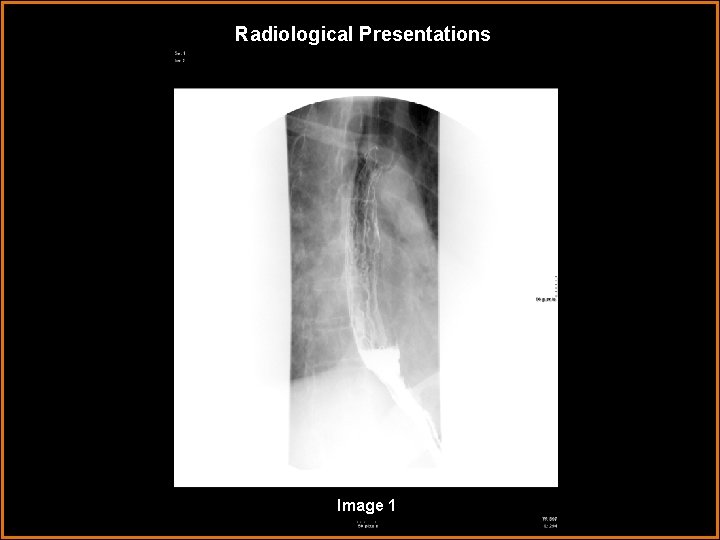 Radiological Presentations Image 1 