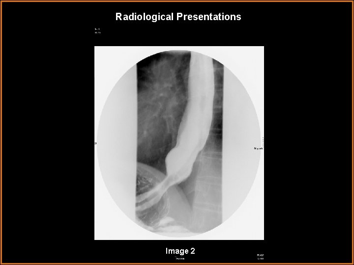 Radiological Presentations Image 2 
