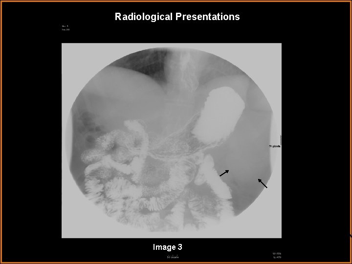 Radiological Presentations Image 3 