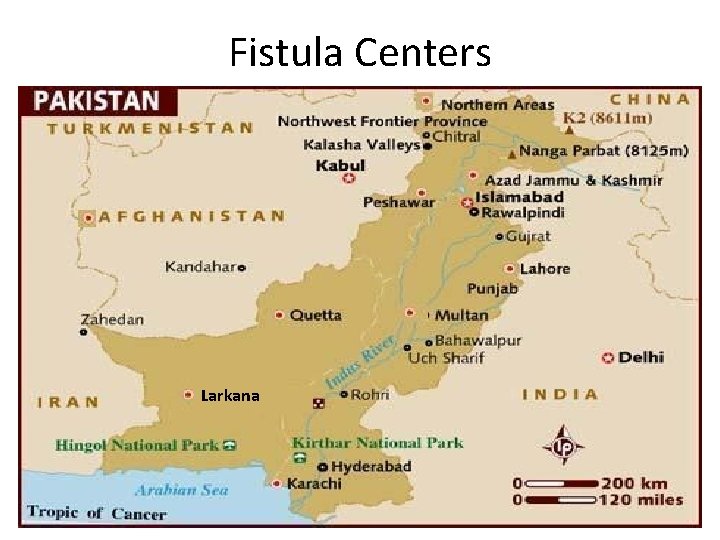 Fistula Centers Larkana 