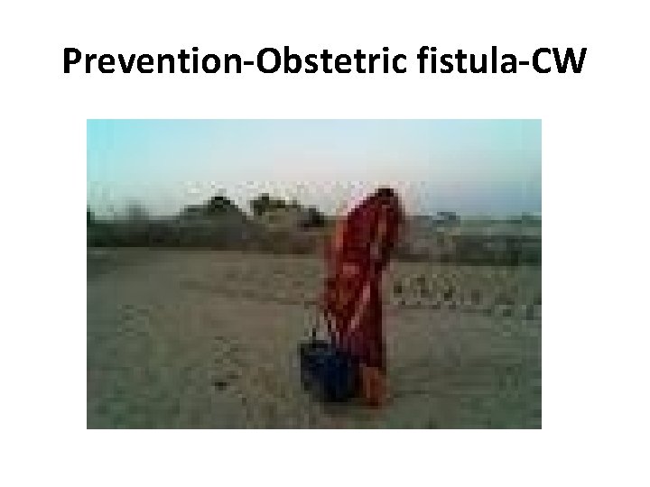 Prevention-Obstetric fistula-CW 