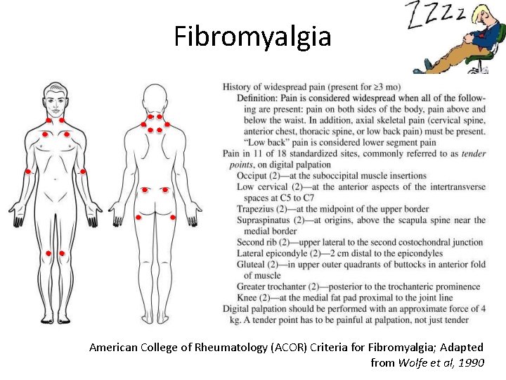 Fibromyalgia American College of Rheumatology (ACOR) Criteria for Fibromyalgia; Adapted from Wolfe et al,