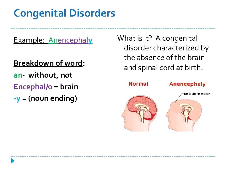 Congenital Disorders Example: Anencephaly Breakdown of word: an- without, not Encephal/0 = brain -y