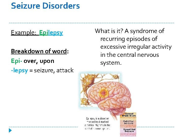 Seizure Disorders Example: Epilepsy Breakdown of word: Epi- over, upon -lepsy = seizure, attack