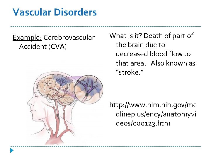 Vascular Disorders Example: Cerebrovascular Accident (CVA) What is it? Death of part of the