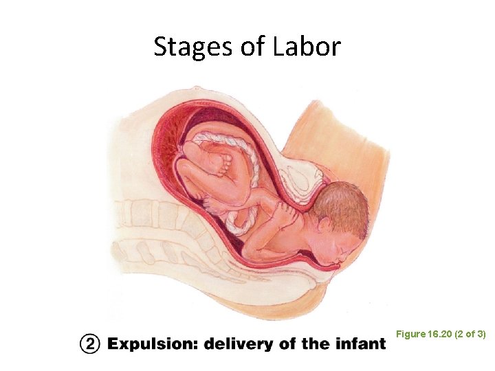 Stages of Labor Figure 16. 20 (2 of 3) Stages of Labor Figure 16. 20 (2 of 3)