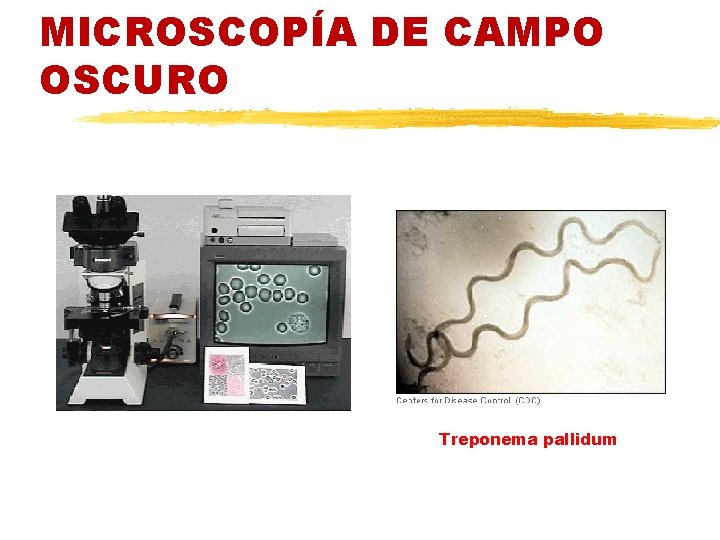 MICROSCOPÍA DE CAMPO OSCURO Treponema pallidum 