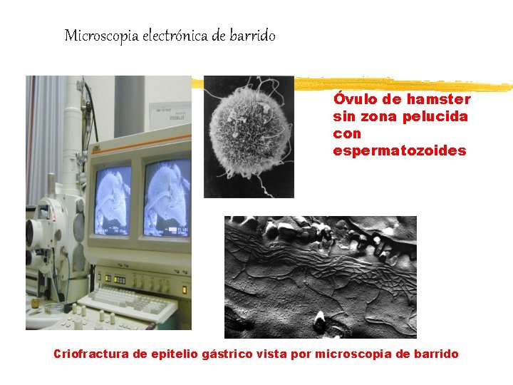 Microscopia electrónica de barrido Óvulo de hamster sin zona pelucida con espermatozoides Criofractura de