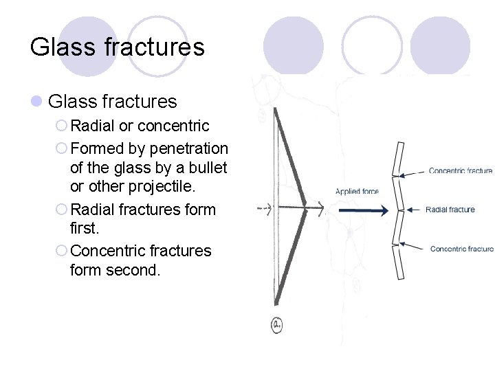 Glass fractures l Glass fractures ¡ Radial or concentric ¡ Formed by penetration of