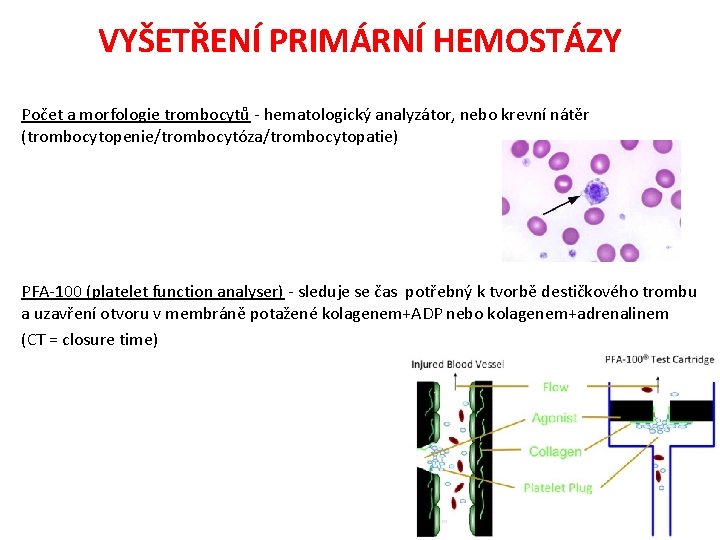 VYŠETŘENÍ PRIMÁRNÍ HEMOSTÁZY Počet a morfologie trombocytů - hematologický analyzátor, nebo krevní nátěr (trombocytopenie/trombocytóza/trombocytopatie)