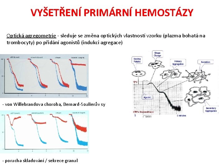 VYŠETŘENÍ PRIMÁRNÍ HEMOSTÁZY Optická agregometrie - sleduje se změna optických vlastností vzorku (plazma bohatá