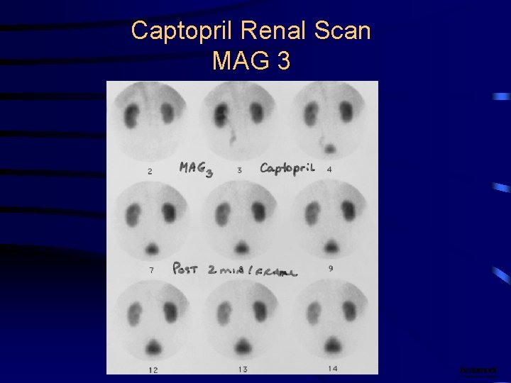 Renal Scintigraphy Materials For Medical Students Helena Balon
