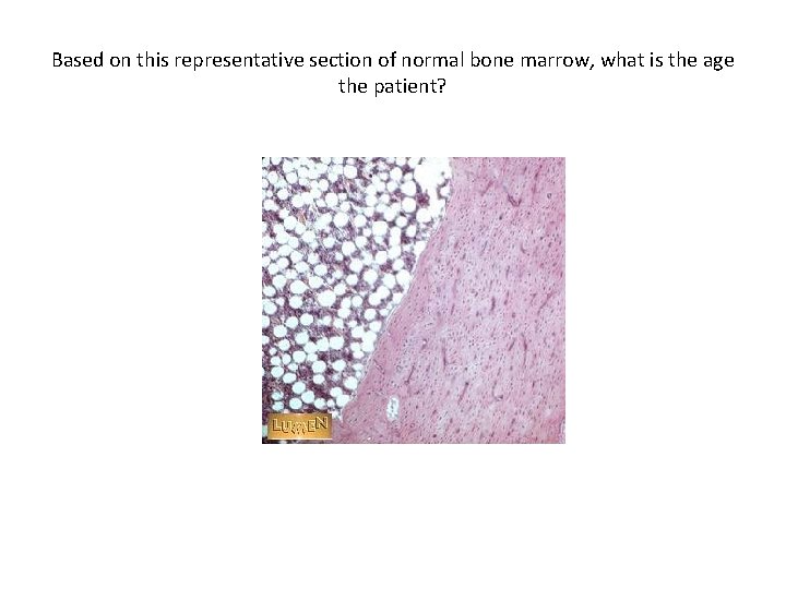 Based on this representative section of normal bone marrow, what is the age the