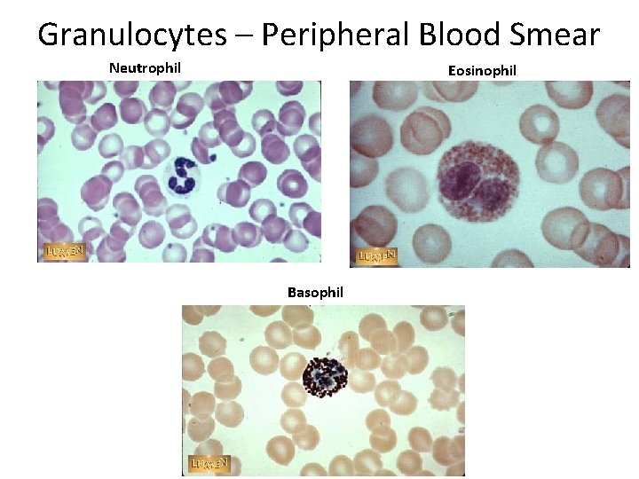 Granulocytes – Peripheral Blood Smear Neutrophil Eosinophil Basophil 