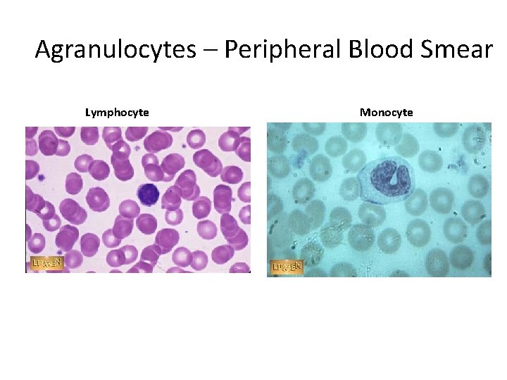 Agranulocytes – Peripheral Blood Smear Lymphocyte Monocyte 