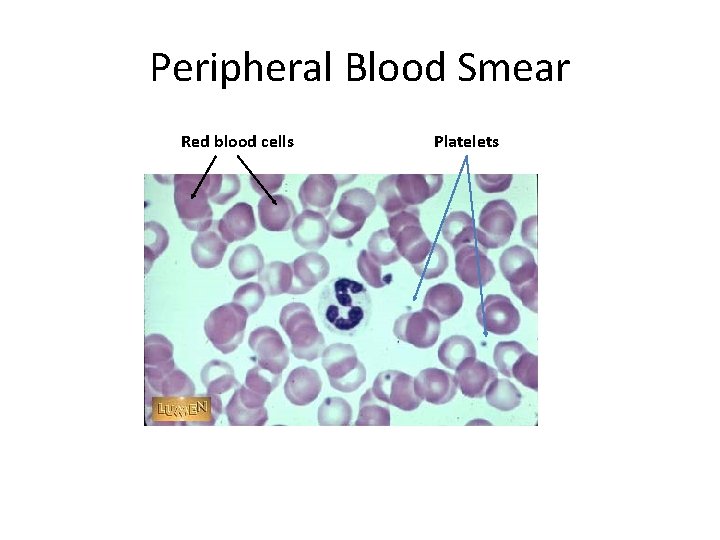 Peripheral Blood Smear Red blood cells Platelets 