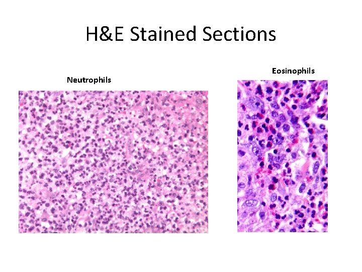 H&E Stained Sections Neutrophils Eosinophils 