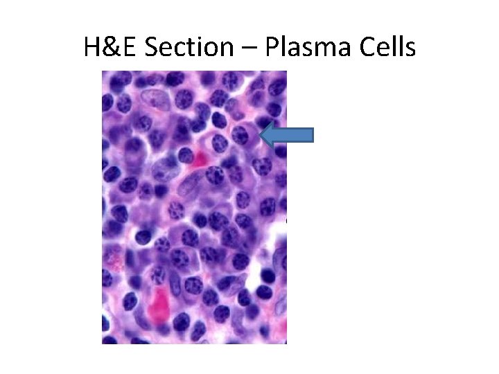 H&E Section – Plasma Cells 