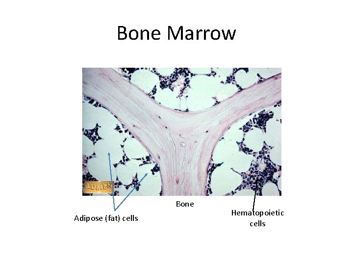 Bone Marrow Bone Adipose (fat) cells Hematopoietic cells 