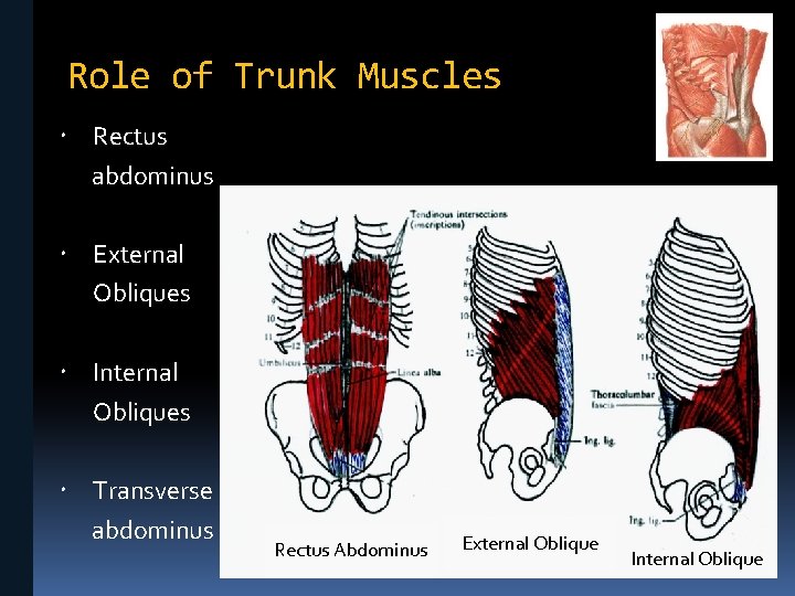 Role of Trunk Muscles Rectus abdominus External Obliques Internal Obliques Transverse abdominus Rectus Abdominus
