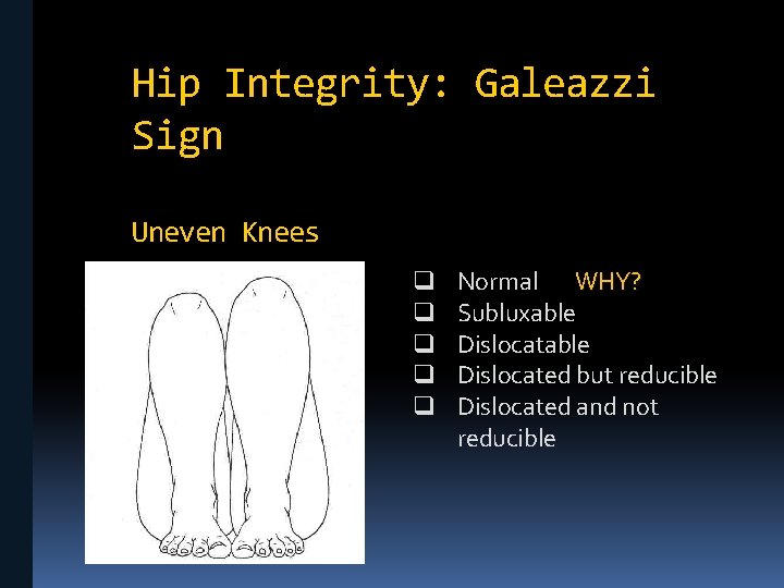 Hip Integrity: Galeazzi Sign Uneven Knees q q q Normal WHY? Subluxable Dislocated but