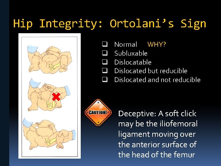 Hip Integrity: Ortolani’s Sign q q q Normal WHY? Subluxable Dislocated but reducible Dislocated