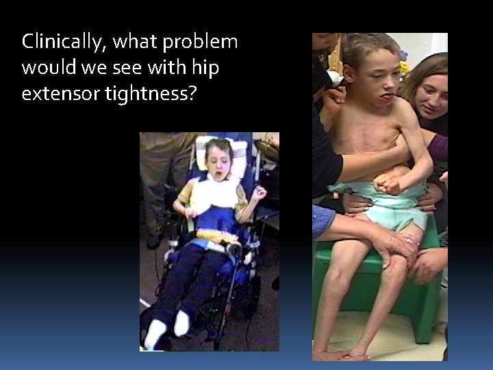 Clinically, what problem would we see with hip extensor tightness? 