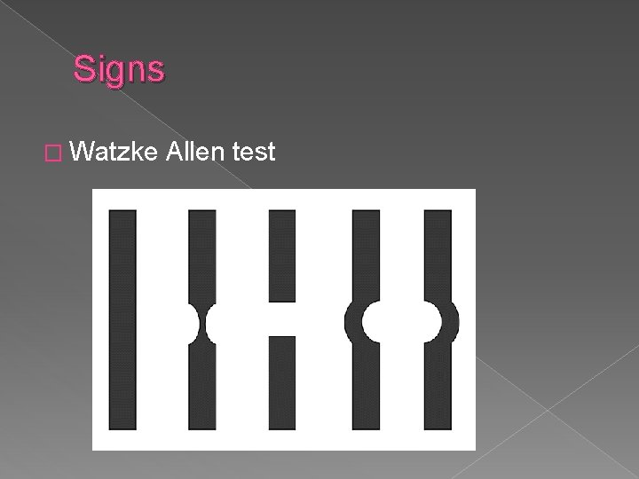 Signs � Watzke Allen test 
