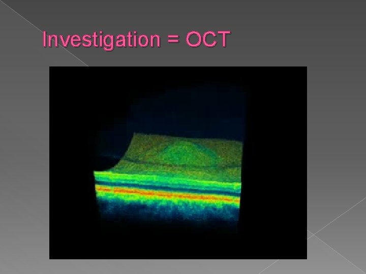 Investigation = OCT 